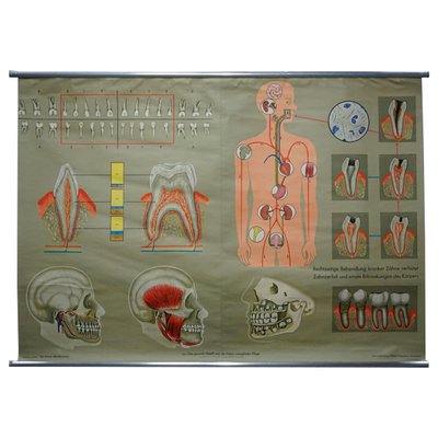 Healthy Teeth Jaw Head Human Body Poster Rollable Wall Chart Print-KJP-1149077