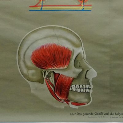 Healthy Teeth Jaw Head Human Body Poster Rollable Wall Chart Print-KJP-1149077