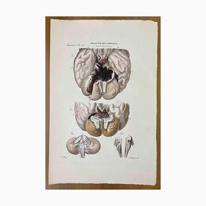 Ottavio Muzzi, Brain Diseases, Lithograph, 1843-ZCI-2030151