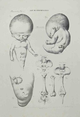 Ottavio Muzzi, Conformation Defects, Lithograph, 1843-ZCI-2029991