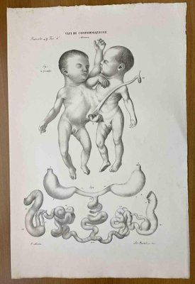 Ottavio Muzzi, Conformation Defects, Lithograph, 1843-ZCI-2030159