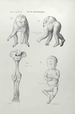 Ottavio Muzzi, Conformation Defects, Lithograph, 1843-ZCI-2029976