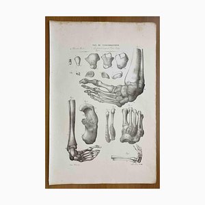 Ottavio Muzzi, Conformation Defects, Lithograph, 1843-ZCI-2030174