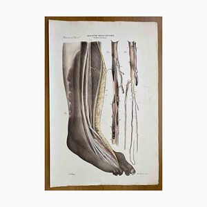 Ottavio Muzzi, Diseases of the Arteries, Lithograph, 1843-ZCI-2030169