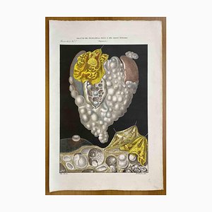 Ottavio Muzzi, Diseases of the Liver, Spleen and Epiploon, Lithograph, 1843-ZCI-2030138