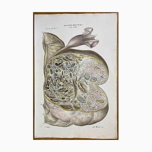 Ottavio Muzzi, Diseases of the Ovary, Lithograph, 1843-ZCI-2030177