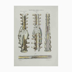 Ottavio Muzzi, Diseases of the Spinal Cord, Lithograph, 1843-ZCI-2029975