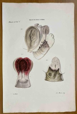 Ottavio Muzzi, Diseases of Uterus, Lithograph, 1843-ZCI-2030141