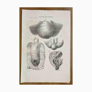 Ottavio Muzzi, Intestinal Diseases, Lithograph, 1843-ZCI-2030143