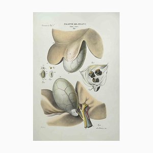 Ottavio Muzzi, Liver Disease, Lithograph, 1843-ZCI-2029983