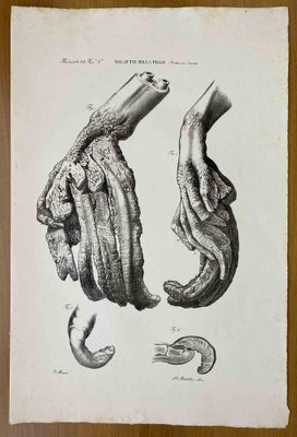 Ottavio Muzzi, Skin Diseases, Lithograph, 1843-ZCI-2030170