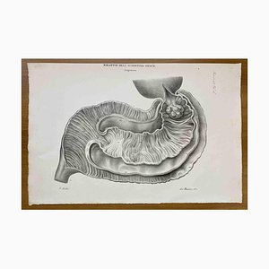 Ottavio Muzzi, Small Intestine Disease, Lithograph, 1843-ZCI-2030155