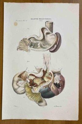 Ottavio Muzzi, Stomach Diseases, Lithograph, 1843-ZCI-2030165