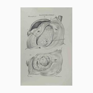 Ottavio Muzzi, Stomach Diseases, Lithograph, 1843-ZCI-2030001